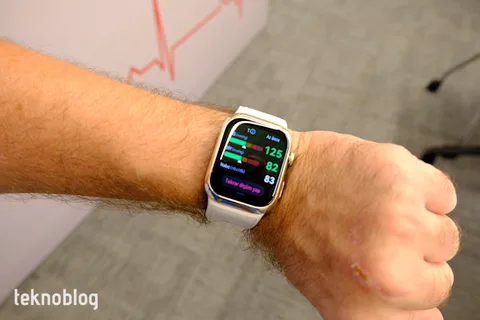 Huawei Watch D2 ile kan basıncı takibi daha hassas ve erişilebilir