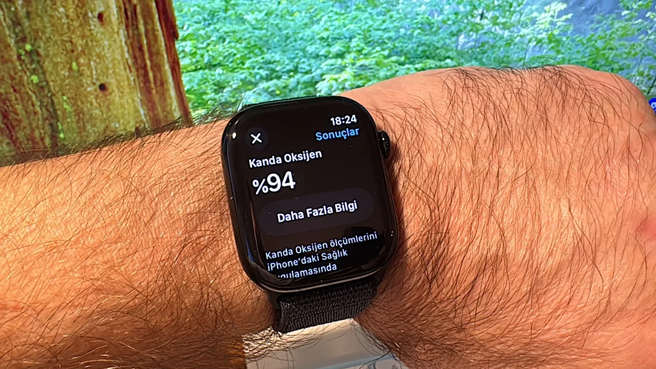 Apple, Apple Watch’taki oksijen sensörü yasağını kaldırmak için yeniden mahkemeye başvurdu