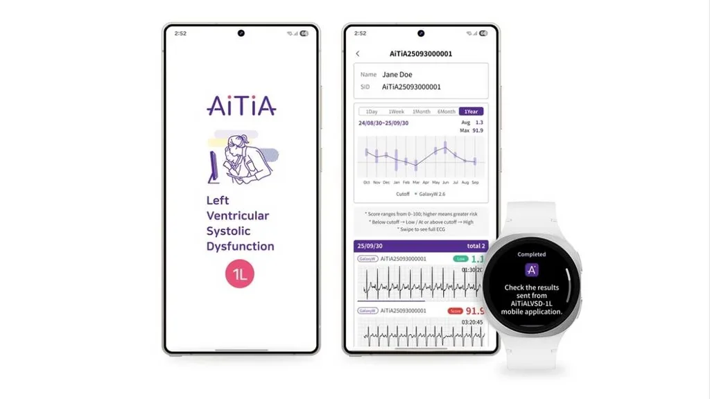 Samsung Galaxy Watch ile kalp yetmezliğine yol açan LVSD erken dönemde tespit edilebilecek
